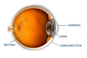 UV damage  Johnson and Johnson Vision Care
